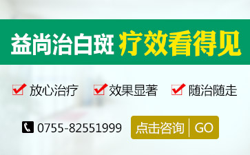 综νʳ